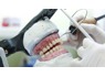 Zirconia Dental Crown Zirconia Dental Lab in