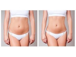 Lipovive Weight Loss Transforming Health and Confidence Naturally The New Era of Weight Management